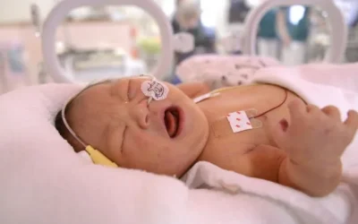 NICU Care Cost for Premature Babies