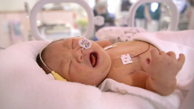 NICU Care Cost for Premature Baby Shenoy Hospital