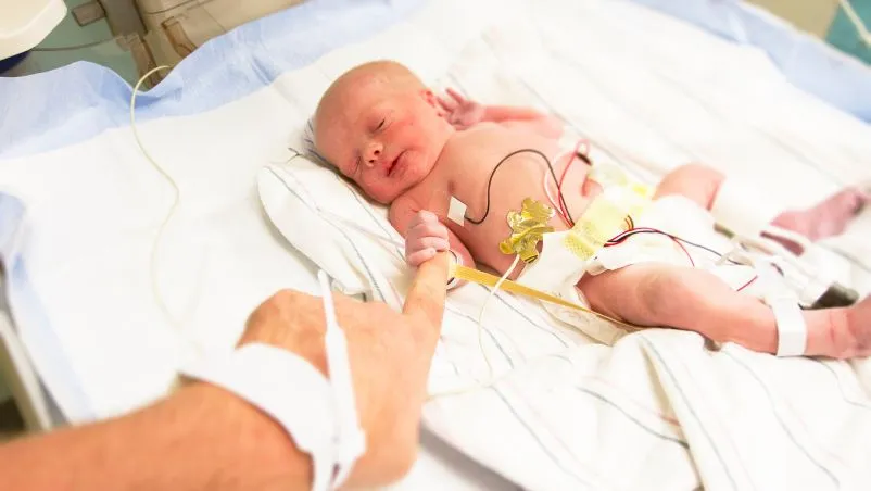 Premature Babies