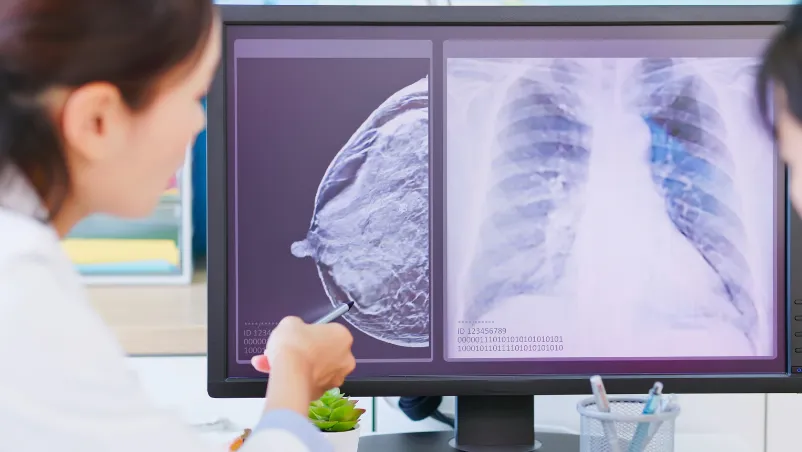 Cancer Screening Packages in Hyderabad — What Is Included & Cost