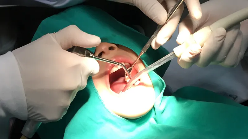 How Much Does Dental Surgery Cost Without Insurance