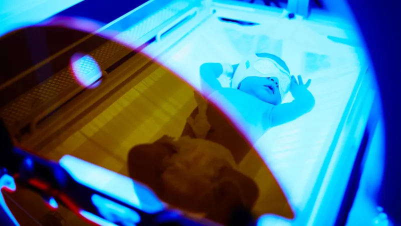 Newborn Jaundice Phototherapy Cost — Treatment Duration & Process