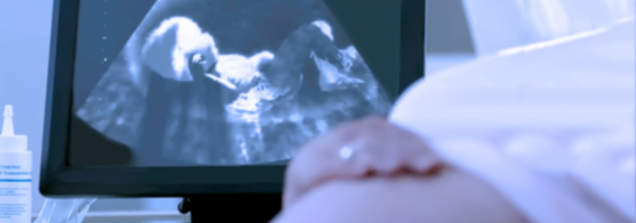 General Surgery Operation