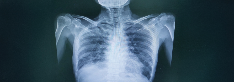 General Surgery Operation